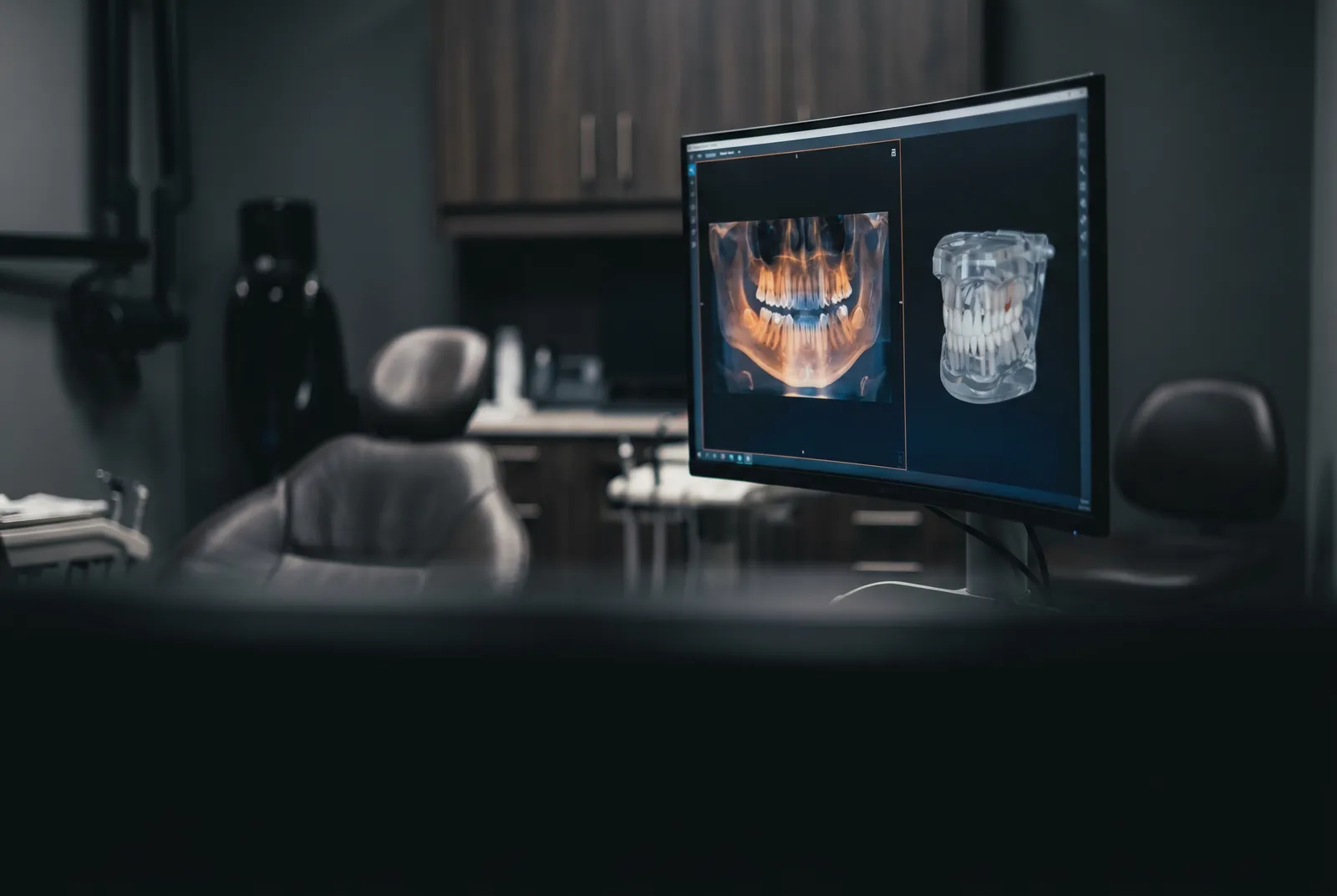 Bone reconstruction (titanium mesh)