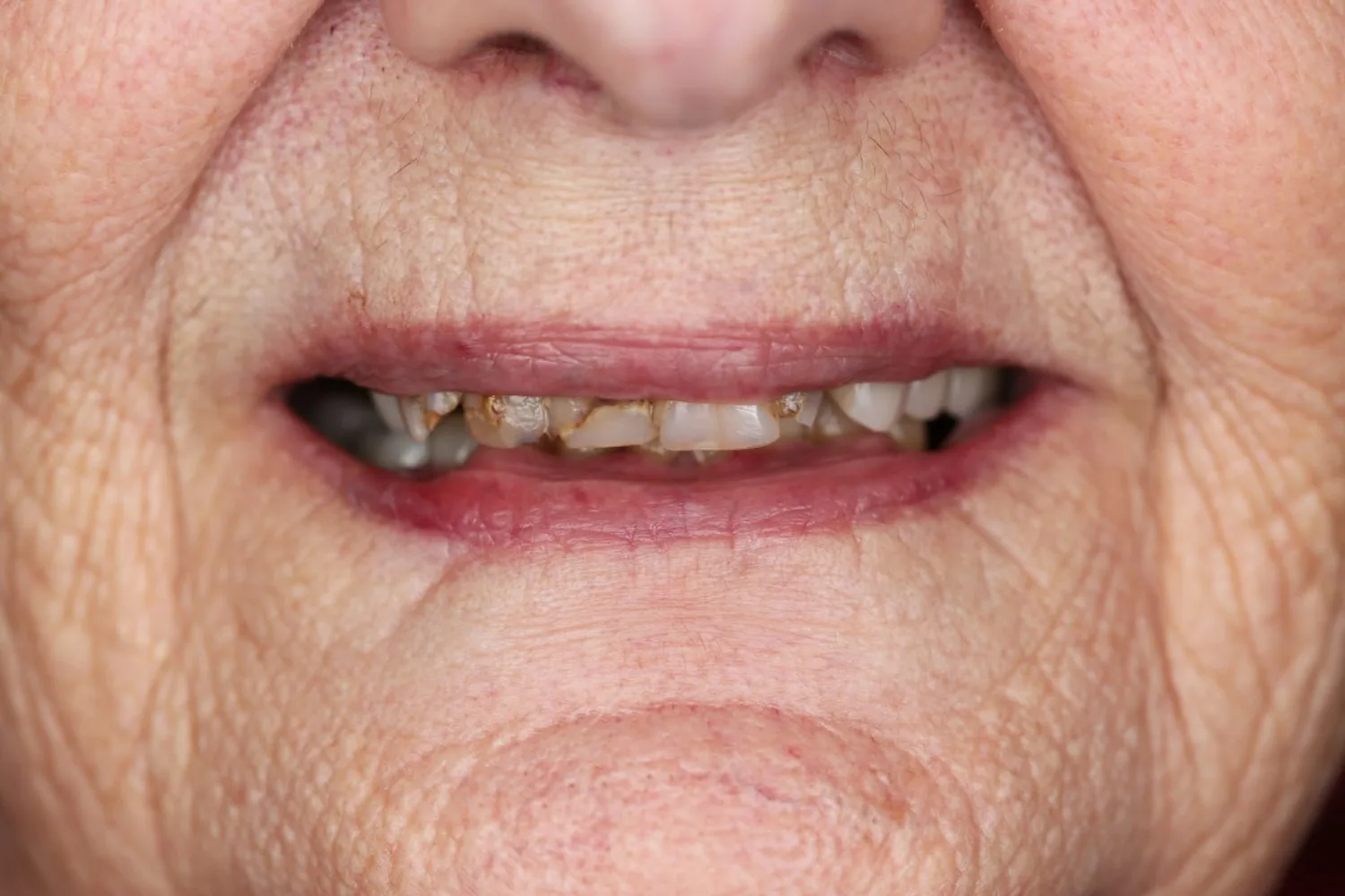The smile she kept putting off — before